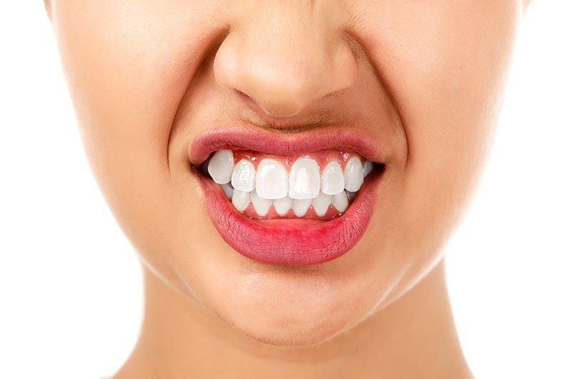 Bruxism: Innovative Solutions for Tackling It Head-On