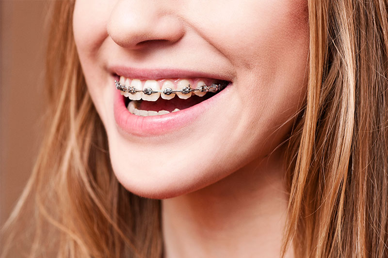 Orthodontics: The Future of Teeth Straightening