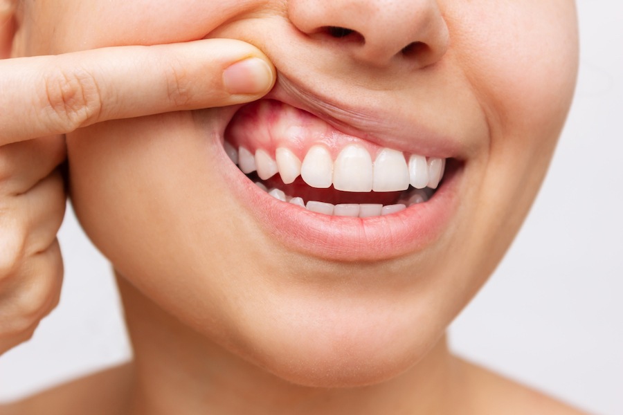 Keeping Your Gums Healthy: Essential Tips and Practices